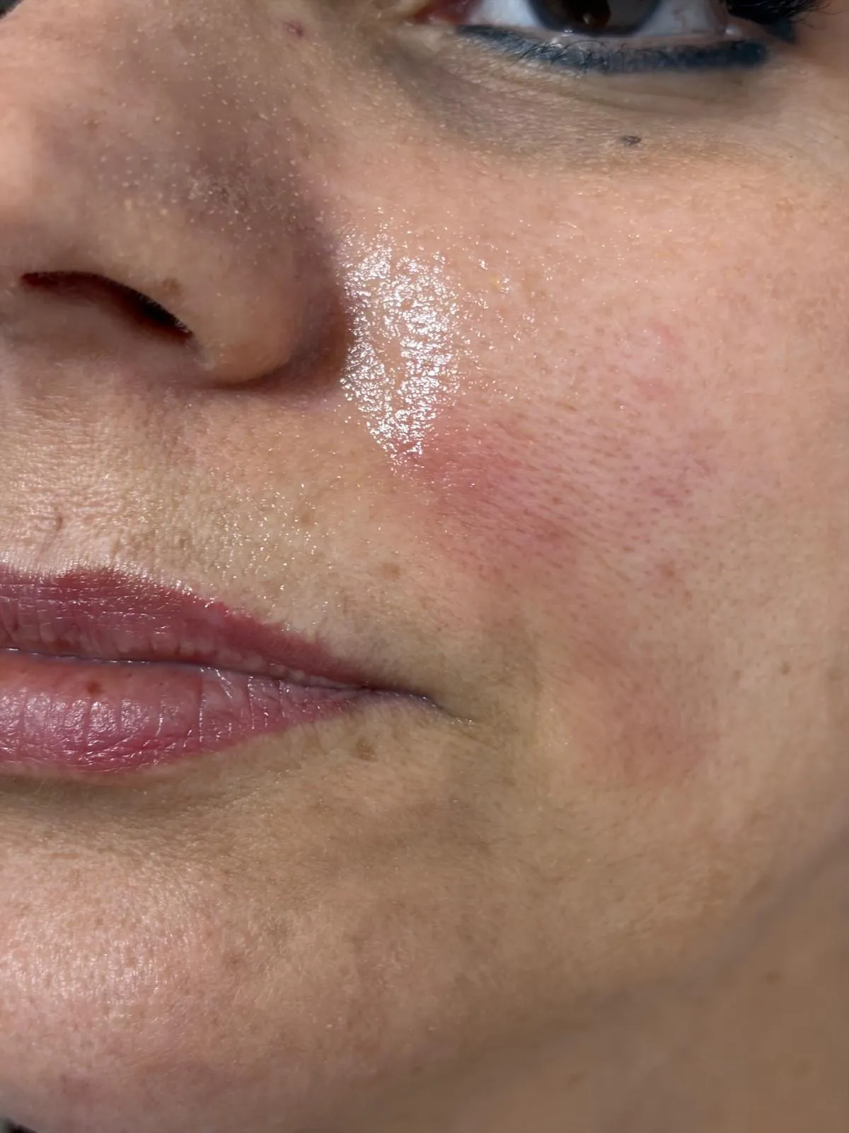 Dete Beauté 10
