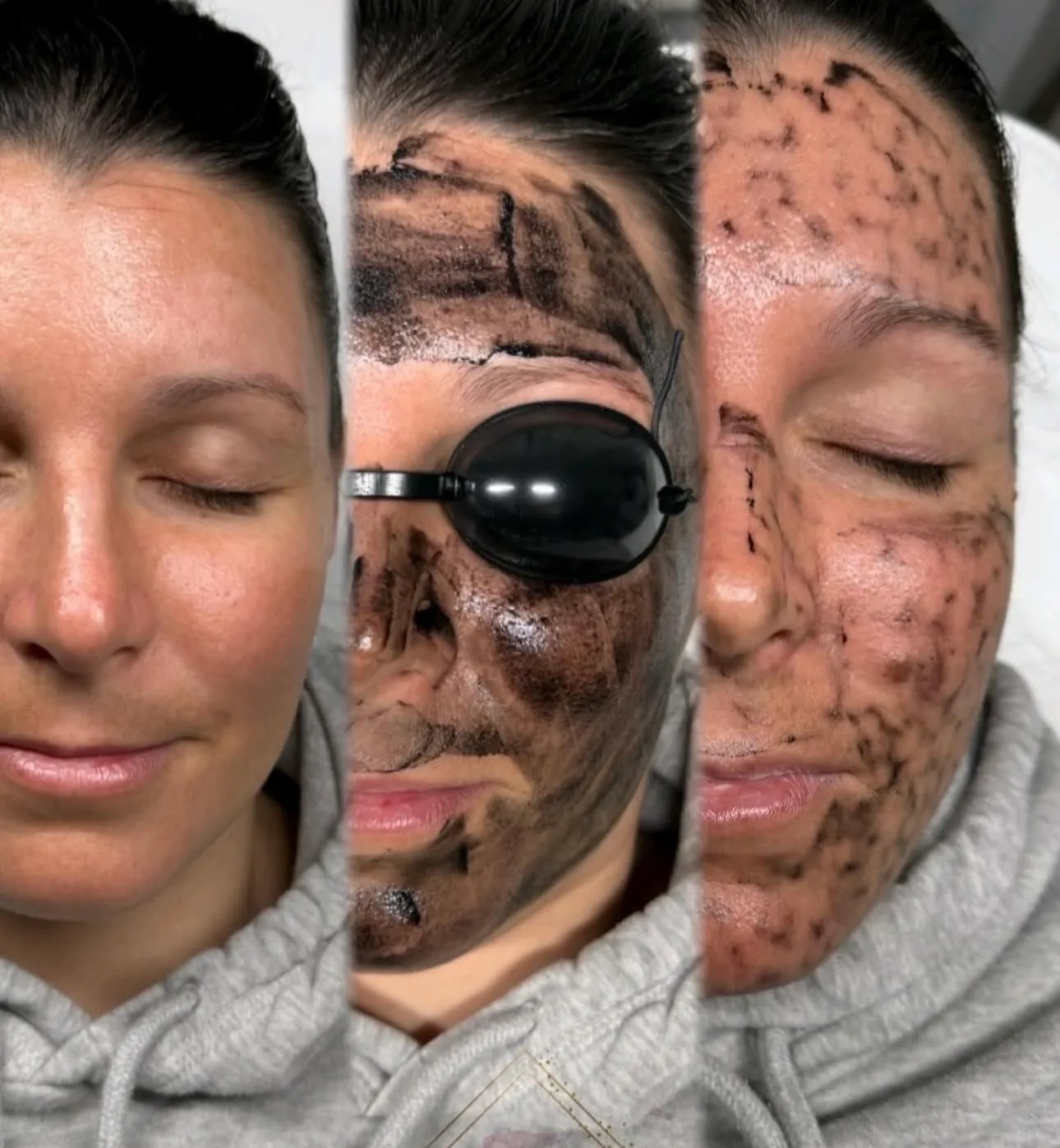 Dete Beauté 17