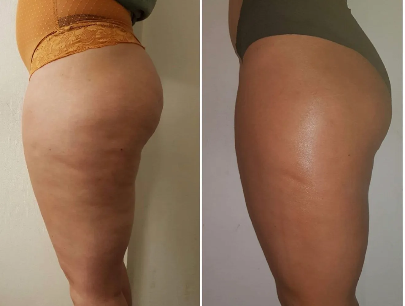 In Beauty gallery 11