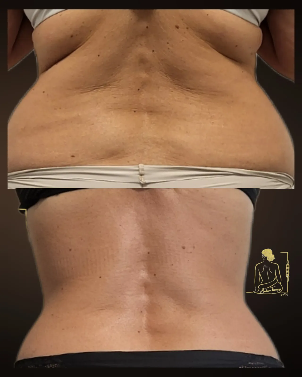 Maderotherapy by M.A gallery 10