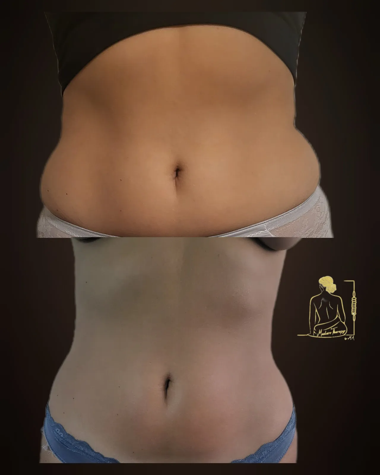 Maderotherapy by M.A gallery 9